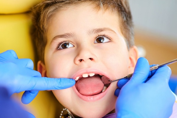 معرفی بهترین روش برای کشیدن دندان کودکان بدون بیهوشی