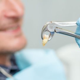 اهمیت دندان عقل در ارتودنسی